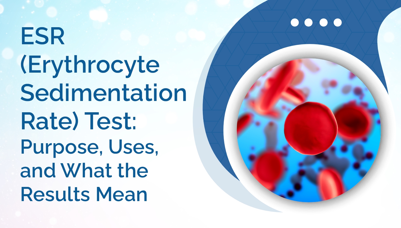 ESR (Erythrocyte Sedimentation Rate) Test: Purpose, Uses, and What the Results Mean